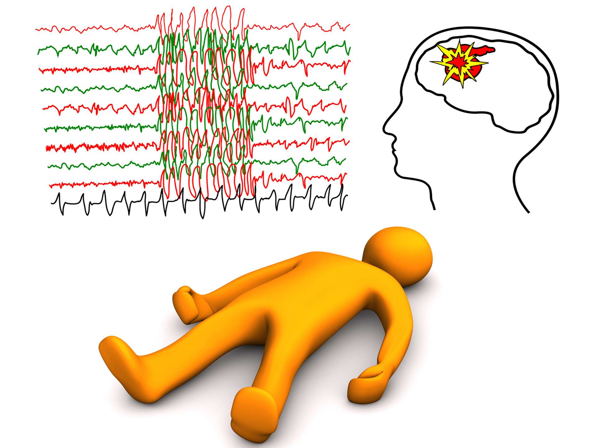 How to communicate with a patient who has a stroke!