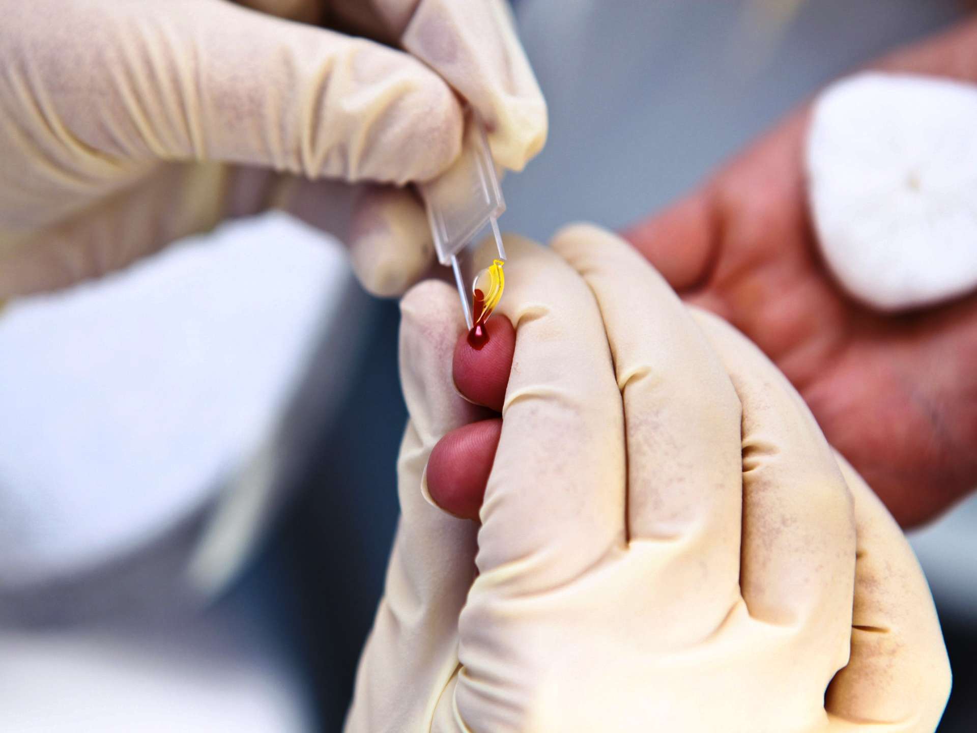 How to know if you have diabetes!