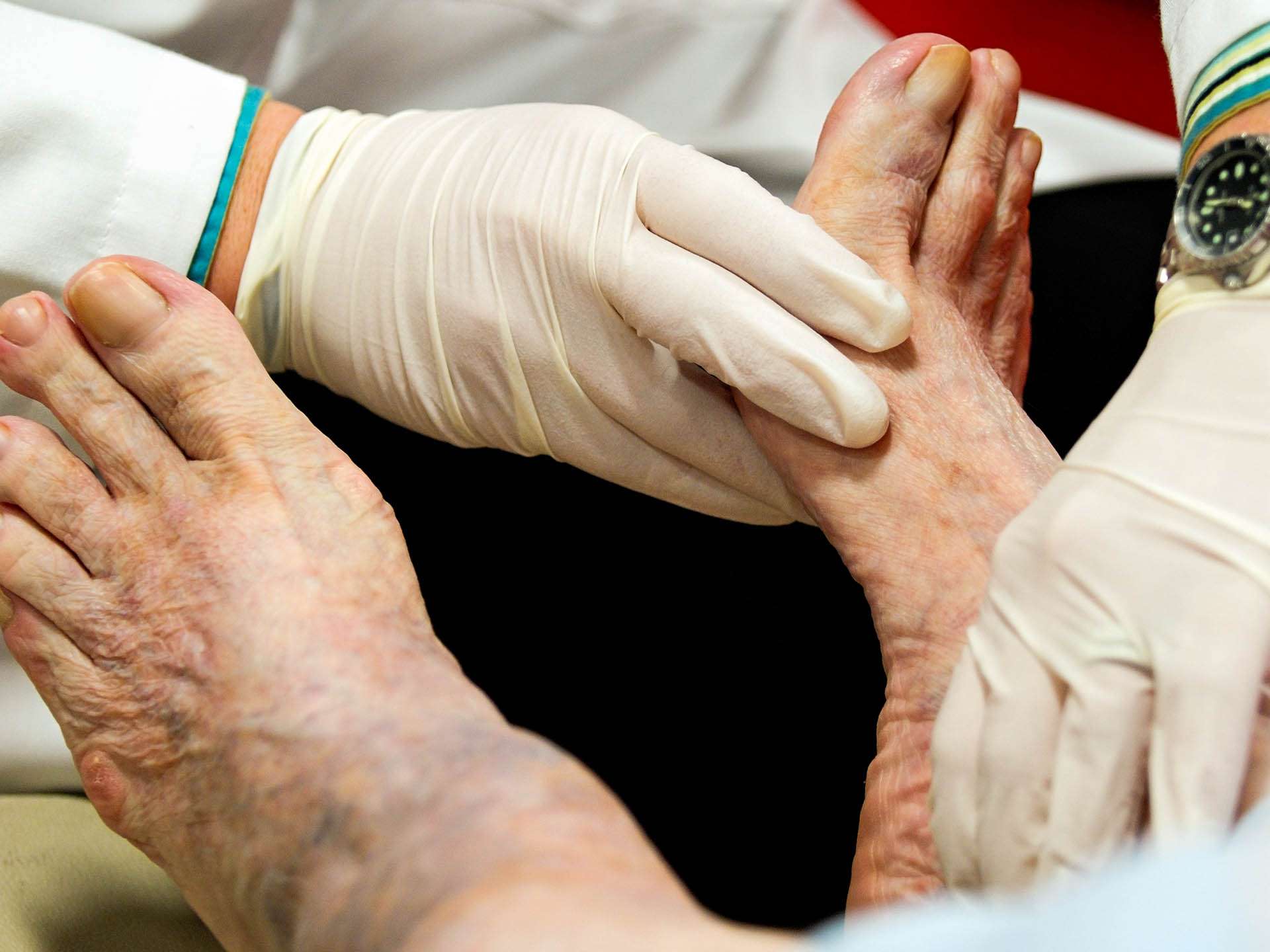 Prevention and treatment of diabetic ulcers!